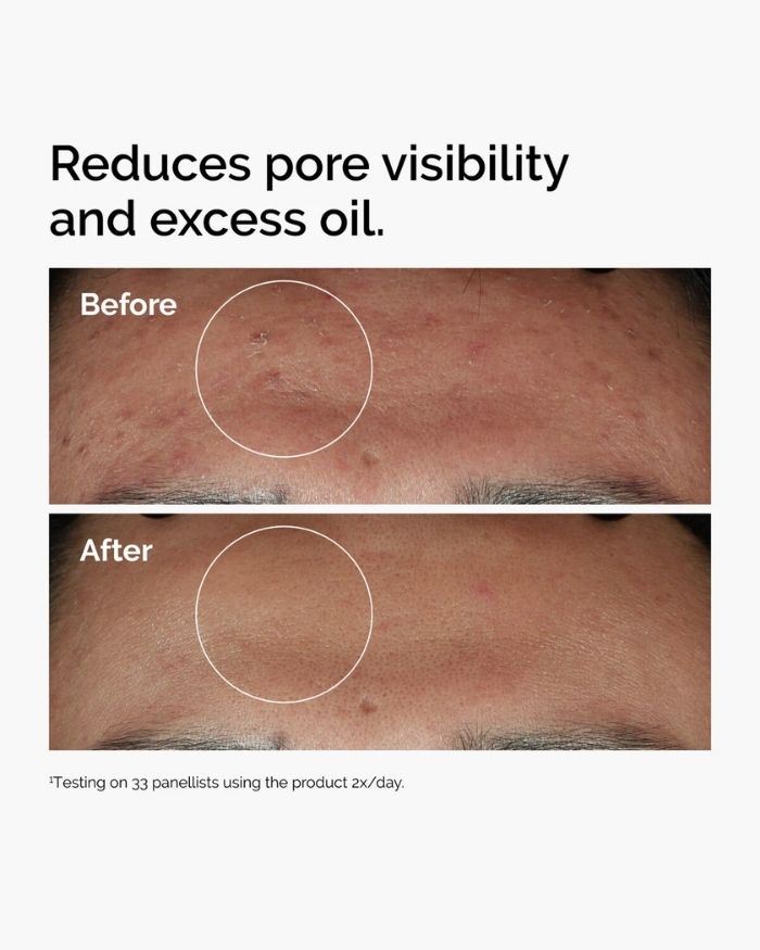 Niacinamide 10% + Zinc 1%