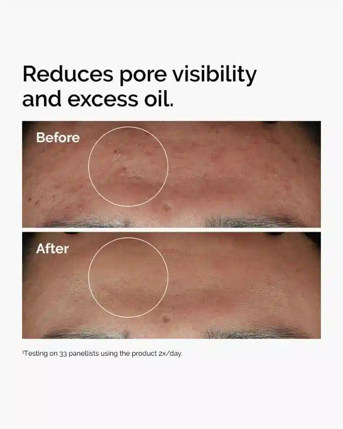Niacinamide 10% + Zinc 1%
