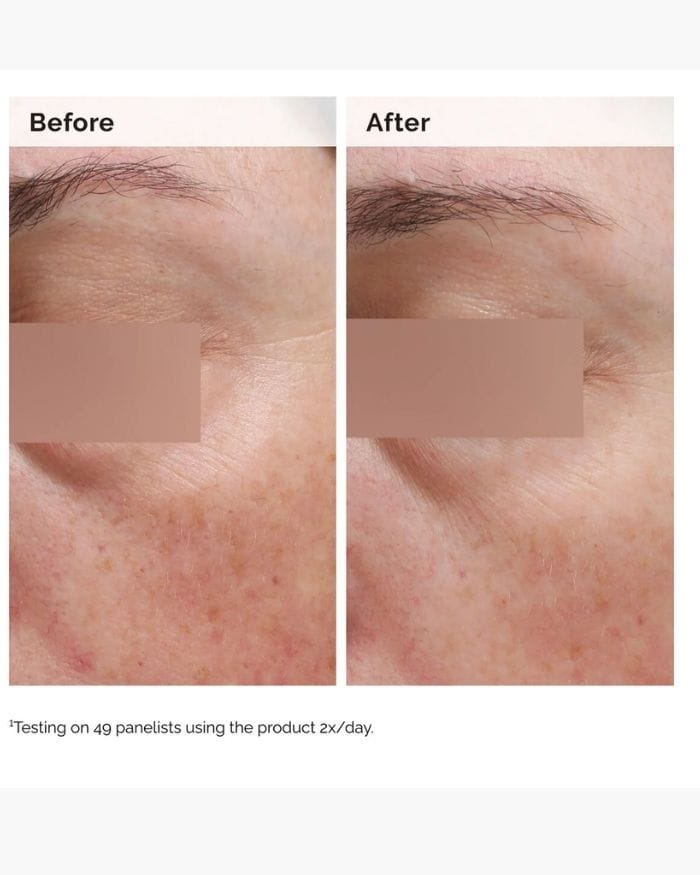Niacinamide 5% Face and Body Emulsion 100ml