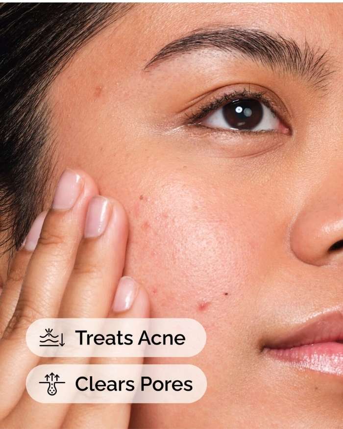 Salicylic Acid 2% Solution