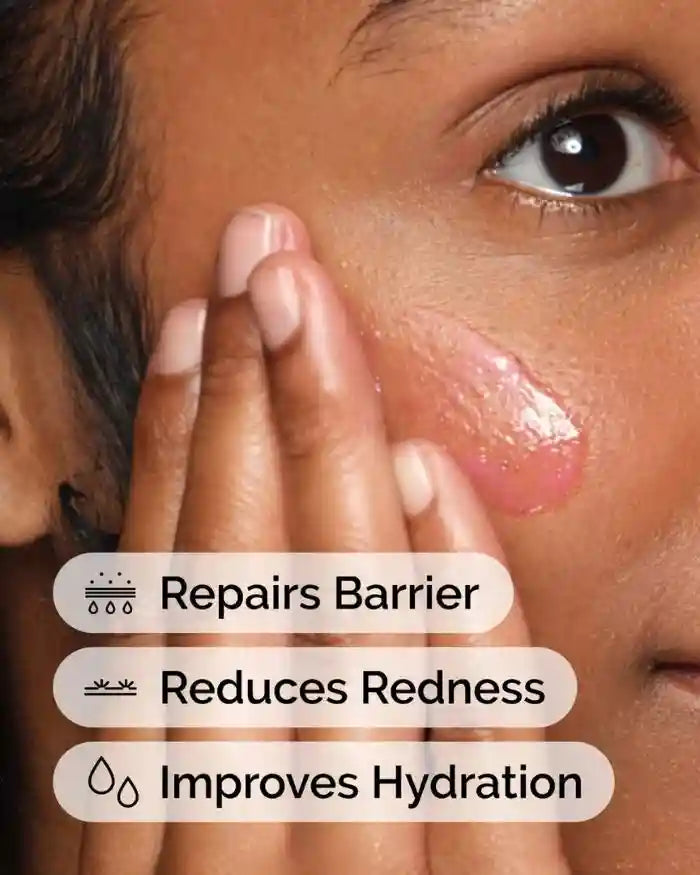 The Ordinary Soothing & Barrier Support Serum