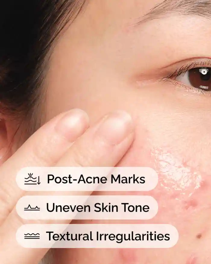 Aloe 2% + Nag 2% Solution Serum