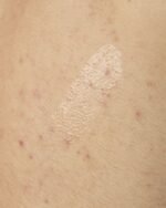 Salicylic Acid 0.5% Body Serum 240ml - Image 3
